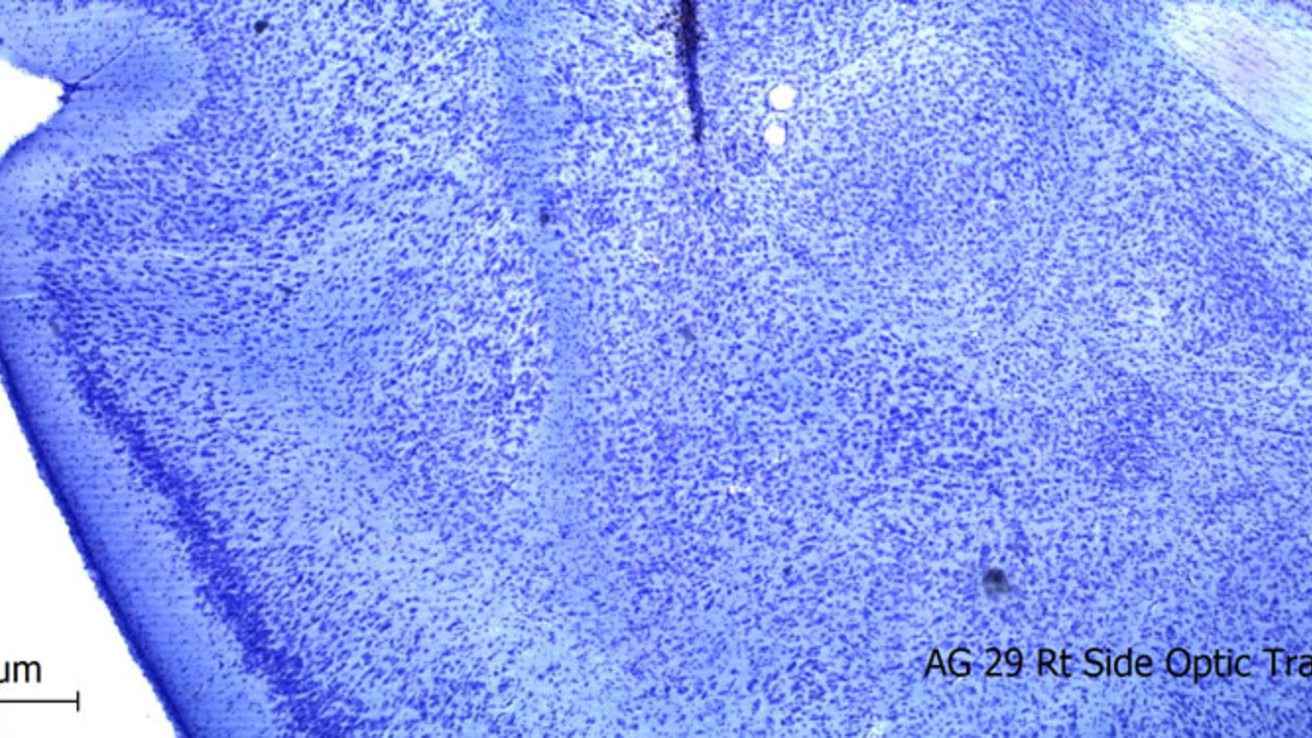 Cresyl violet stain of the basolateral amygdala