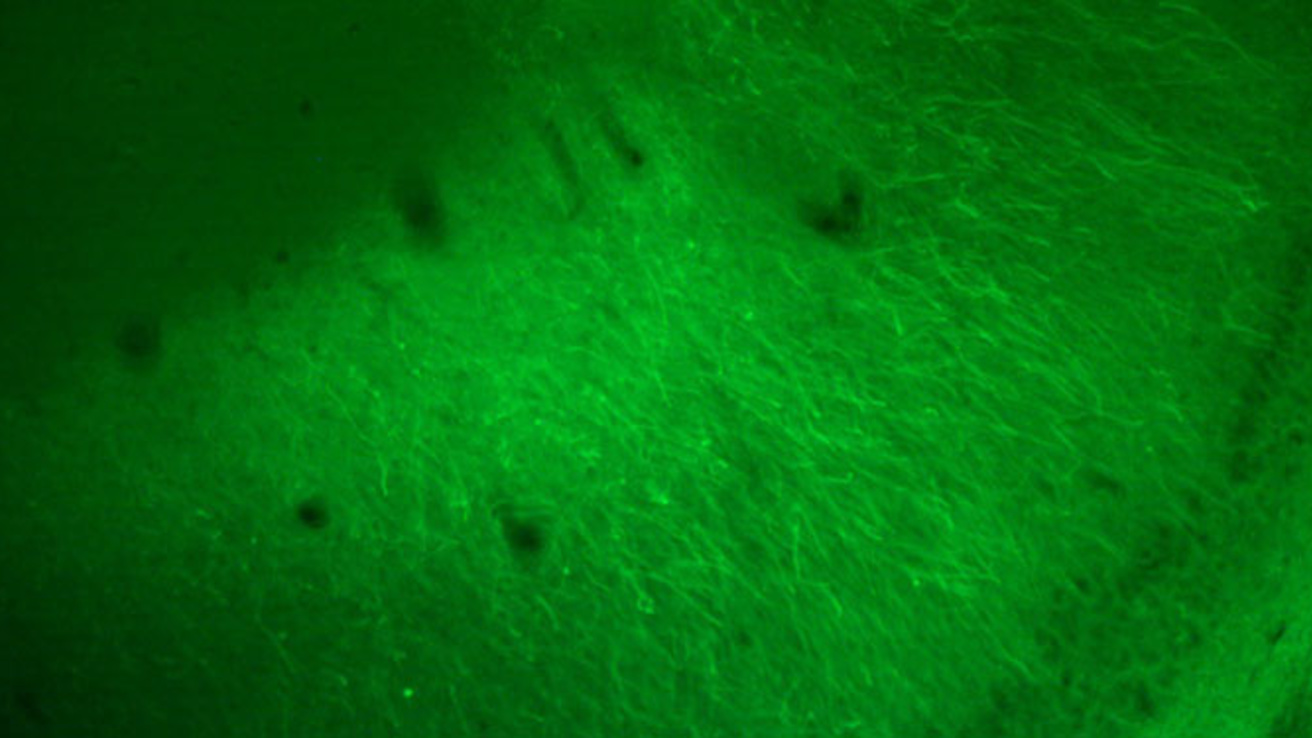 Fluorescent image of opsin-transduced neurons